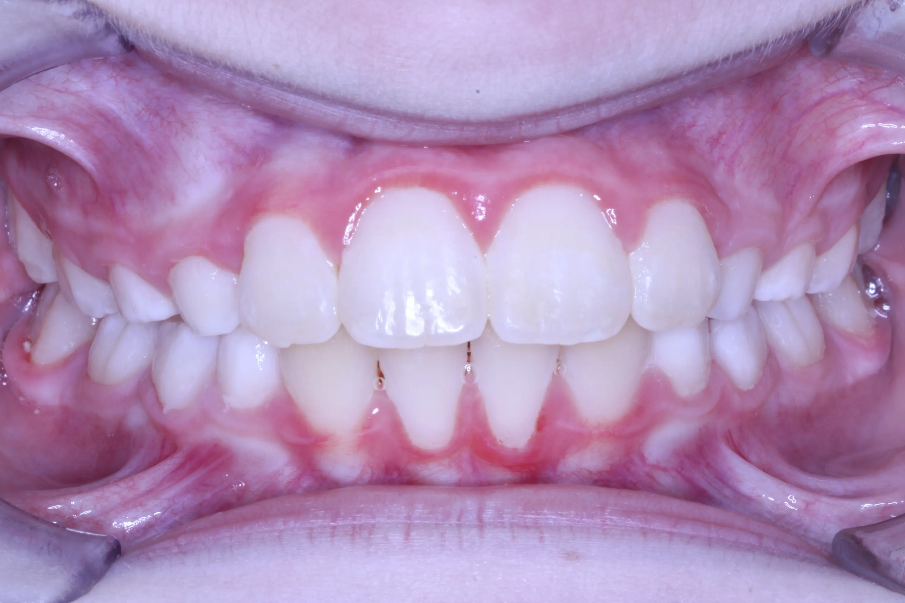 smile-gallery gallery